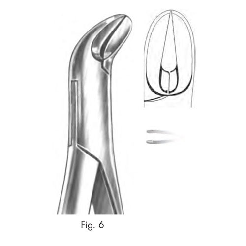 extracting forceps, american pattern - figure 6