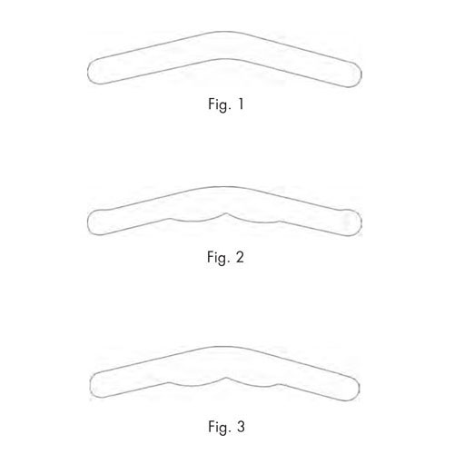 tofflemire matrix retainers