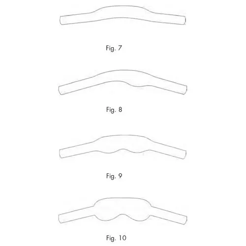matrix bands for molars - 12 pieces