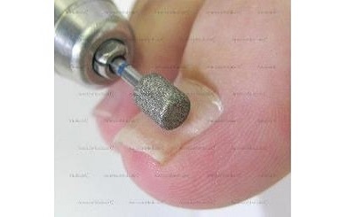 safe-toe round edge grinder podiatry bur